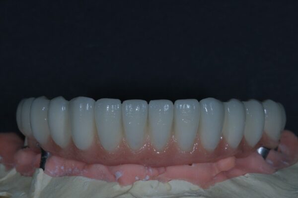 IMG_6529 IMG_6529