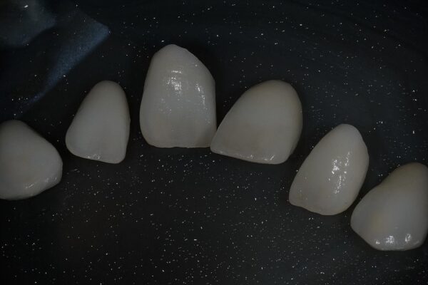 IMG_6531 IMG_6531